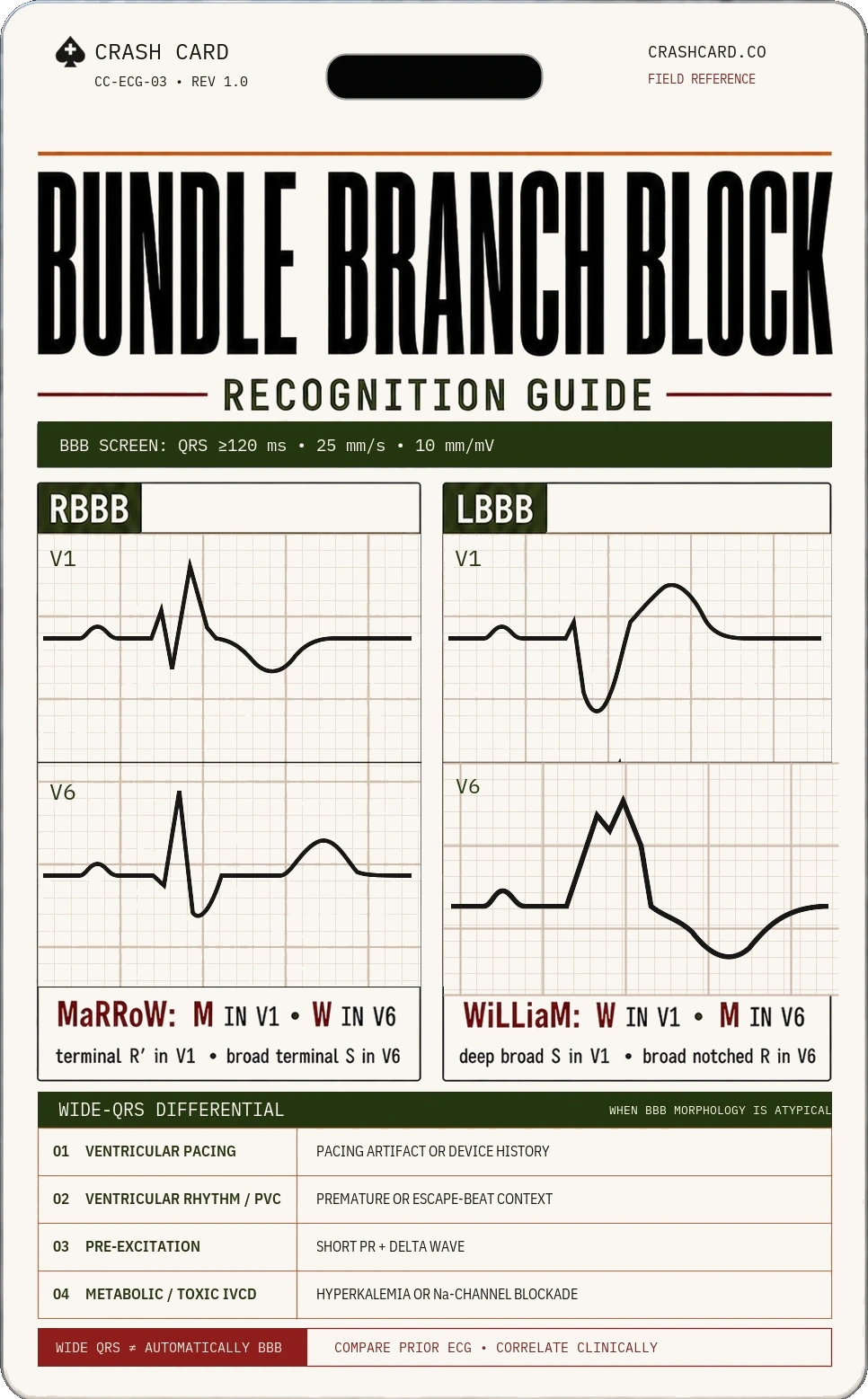 Bundle branch block recognition face of the Crash Card