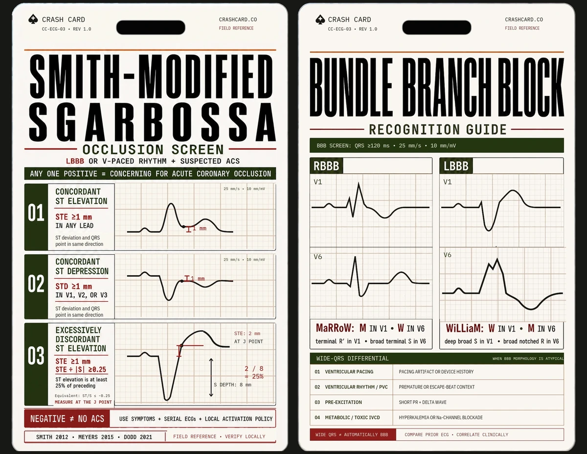Both faces of the Crash Card: Smith-modified Sgarbossa and bundle branch block recognition