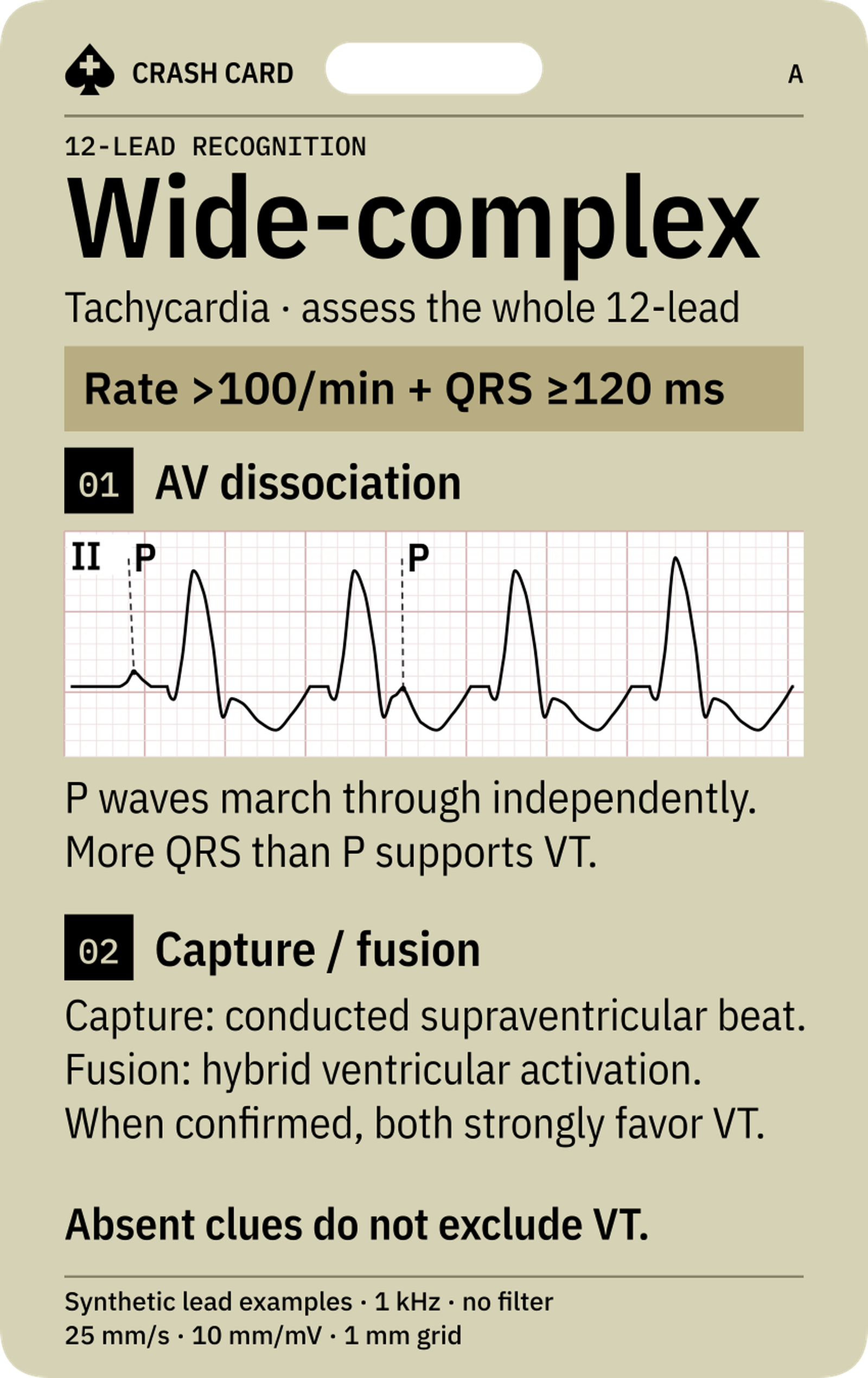 Wide-complex Tachycardia — front: AV dissociation and capture/fusion context