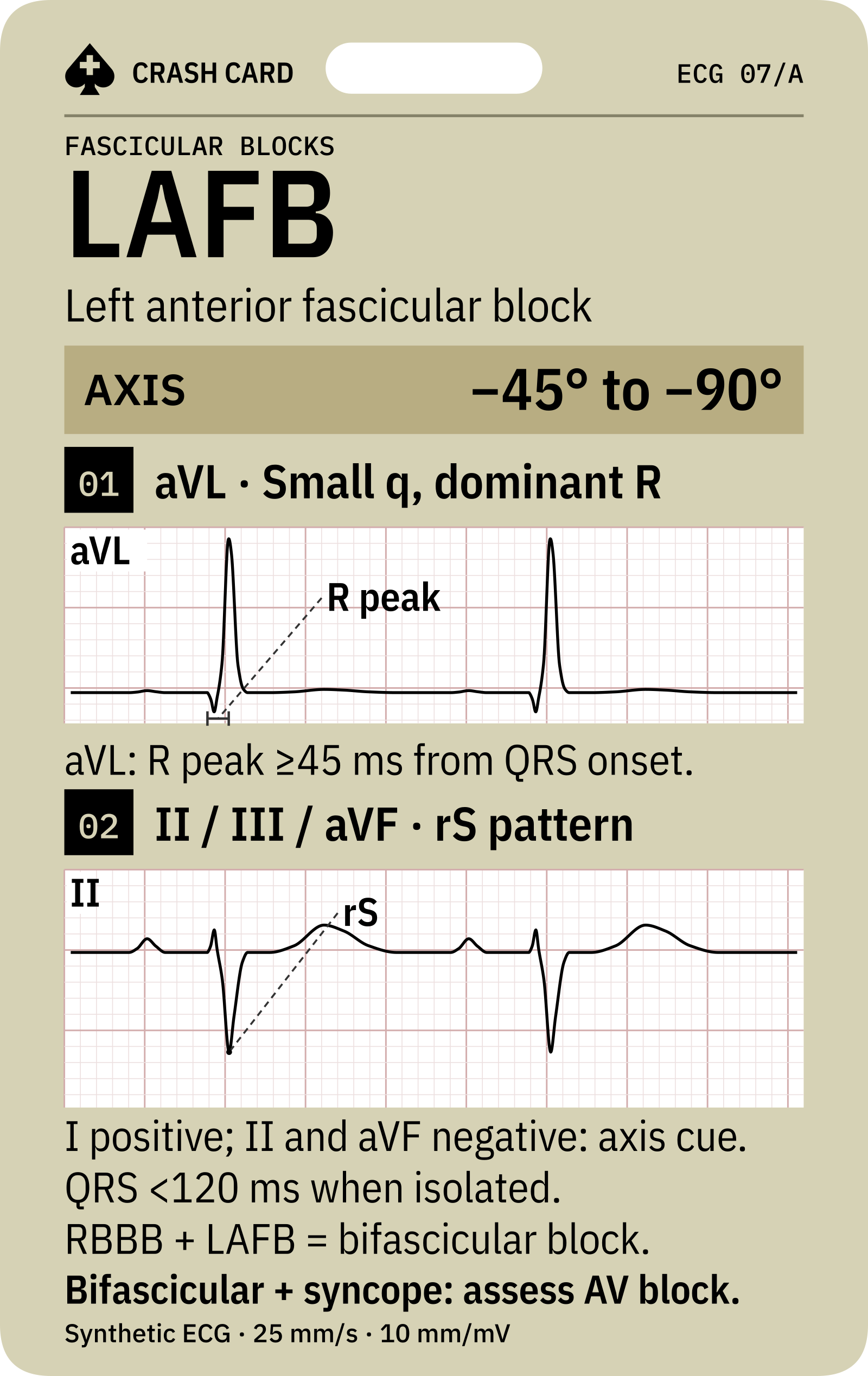 LAFB axis and aVL and inferior-lead morphology