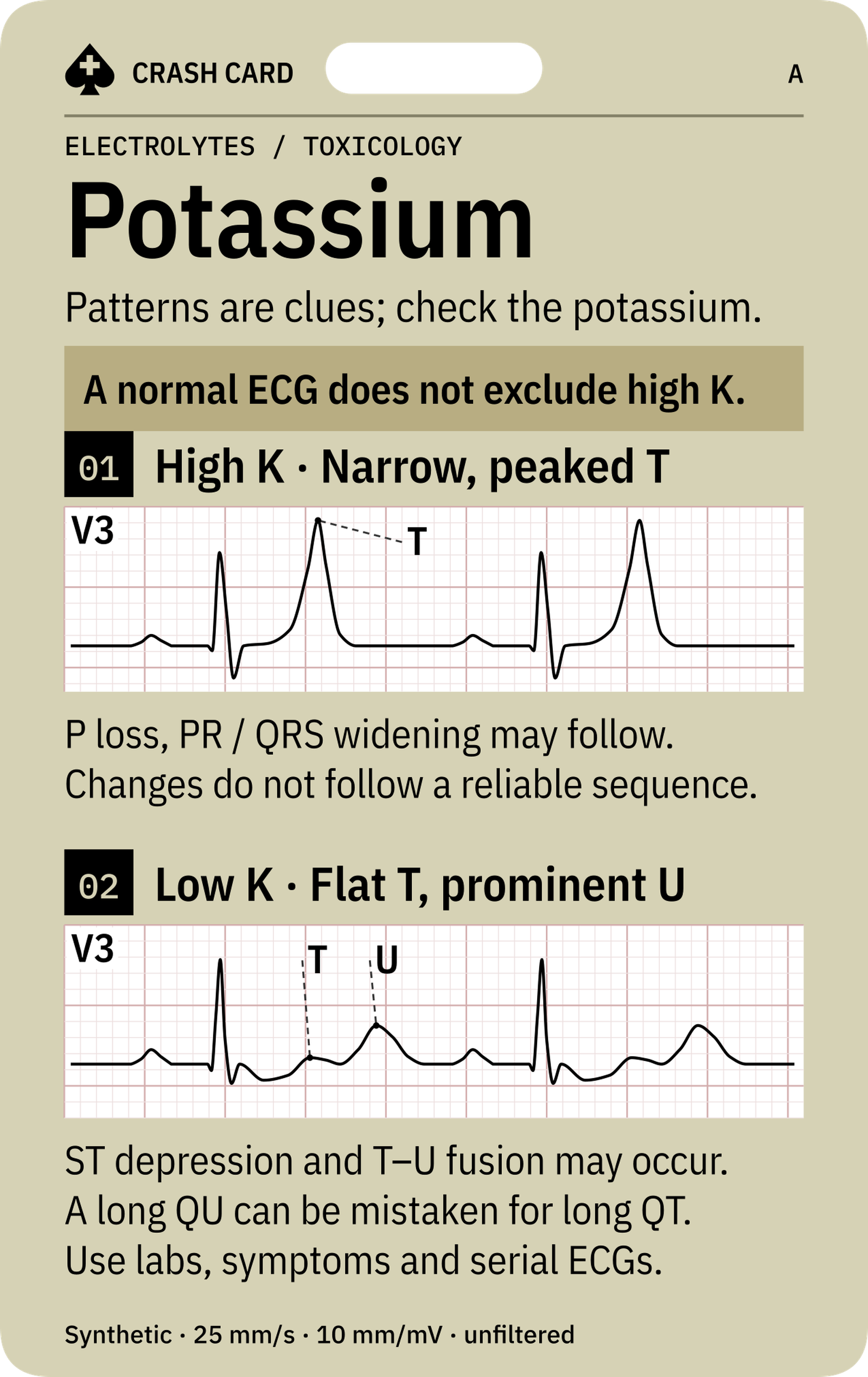 Potassium & Toxicologic ECG — front: High-potassium T and low-potassium T/U examples