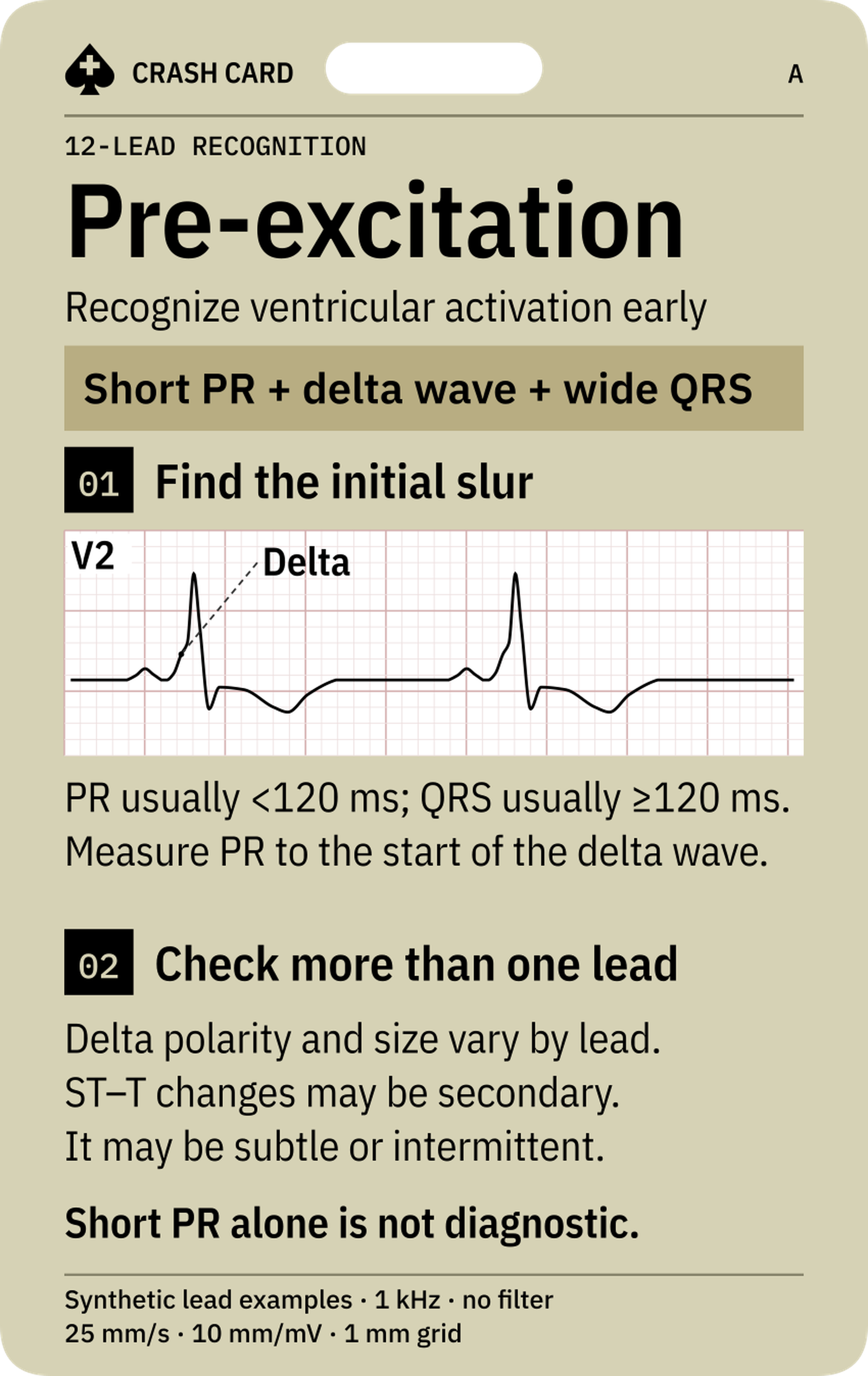 Pre-excitation Recognition — front: Positive and negative delta-wave pointers