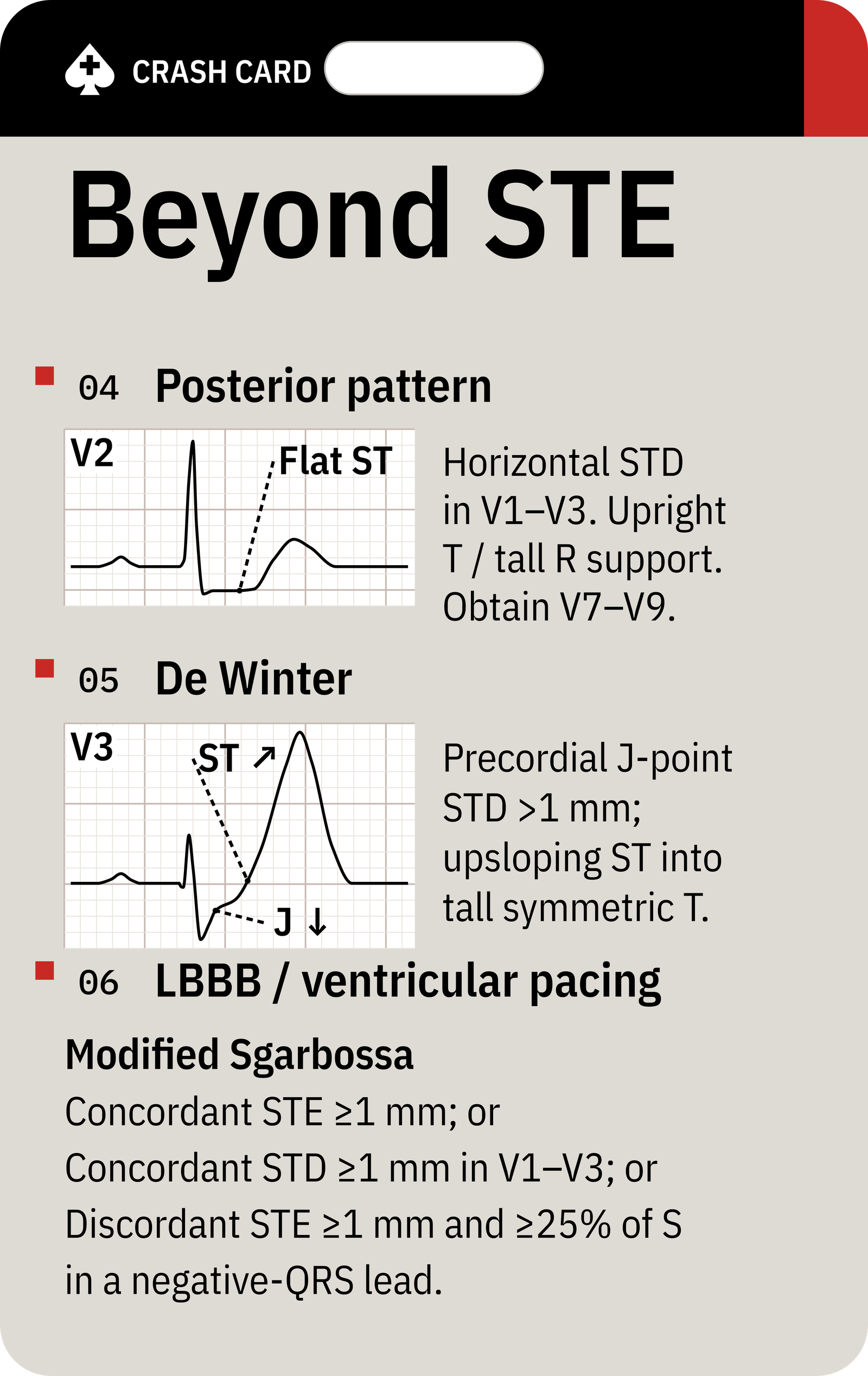OMI Recognition — back: Modified Sgarbossa reminder and urgent assessment context