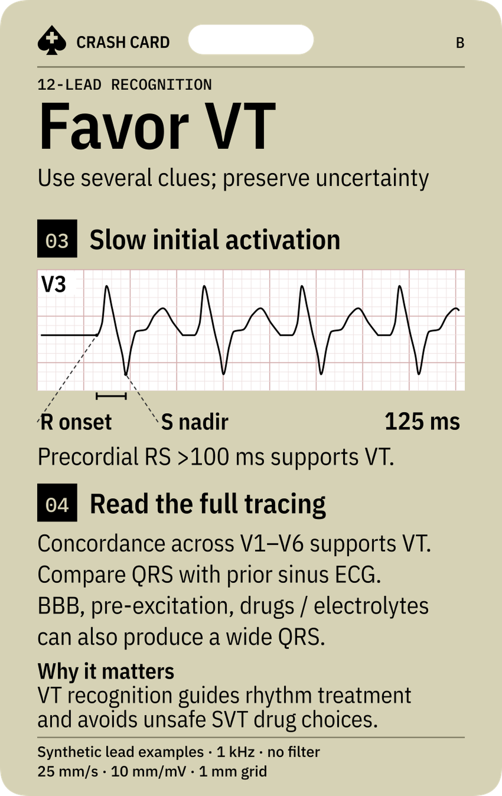 Wide-complex Tachycardia — back: Why recognition guides rhythm treatment and drug choices